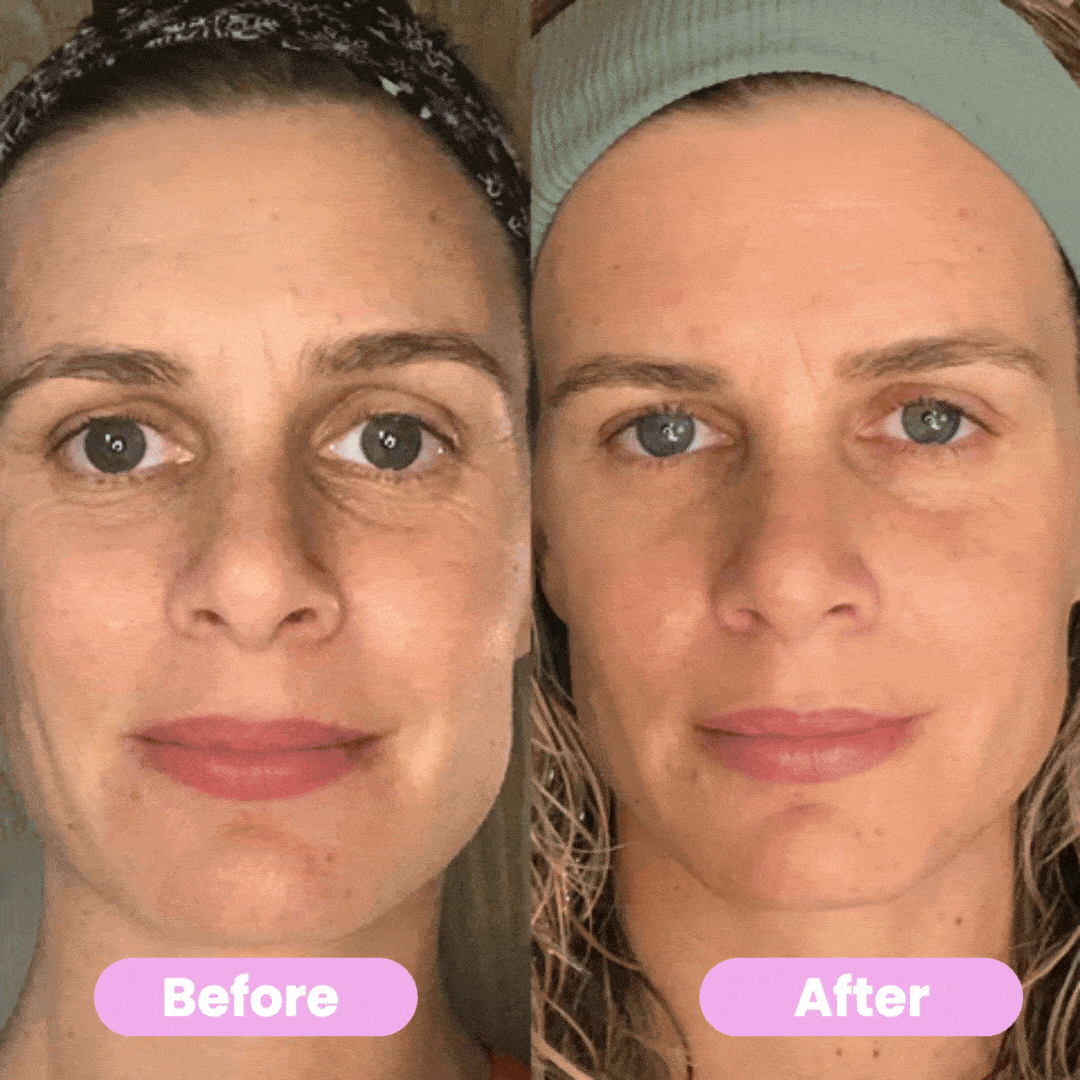 Nova Lane 7-In-1 LED Facial Sculptor